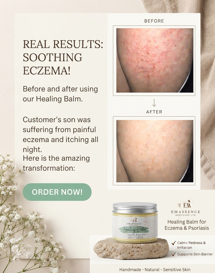 Natural Healing Balm